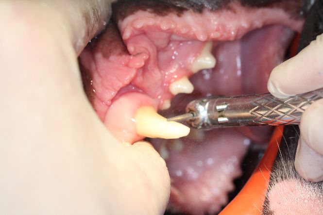 Preparing the tooth for the metal crown
